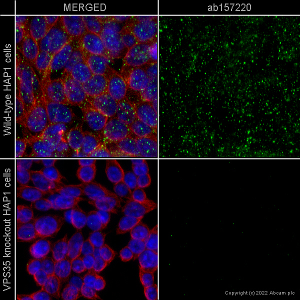 Immunocytochemistry/ Immunofluorescence - Anti-VPS35 antibody [EPR11501(B)] (ab157220), expandable thumbnail