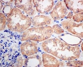 Immunohistochemistry (Formalin/PFA-fixed paraffin-embedded sections) - Anti-VPS35 antibody [EPR11501(B)] (AB157220), expandable thumbnail