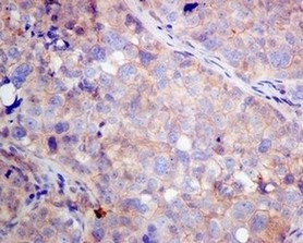 Immunohistochemistry (Formalin/PFA-fixed paraffin-embedded sections) - Anti-VPS35 antibody [EPR11501(B)] (AB157220), expandable thumbnail