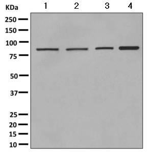 Western blot - Anti-VPS35 antibody [EPR11501(B)] (AB157220), expandable thumbnail