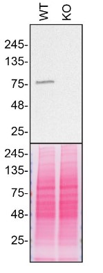 Western blot - Anti-VPS35 antibody [EPR11501(B)] (ab157220), expandable thumbnail