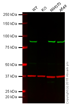 Western blot - Anti-VPS35 antibody [EPR11501(B)] (AB157220), expandable thumbnail