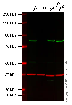 Western blot - Anti-VPS35 antibody [EPR11501(B)] (AB157220)