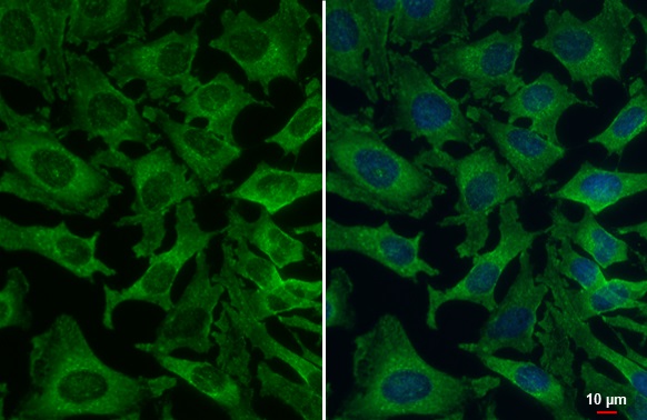 Immunocytochemistry/ Immunofluorescence - Anti-VPS35 antibody [HL1017] (ab308334), expandable thumbnail