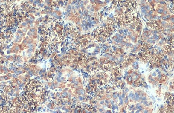 Immunohistochemistry paraffin embedded sections - Anti-VPS35 antibody [HL1017] (ab308334), expandable thumbnail