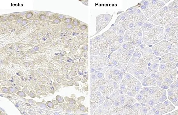 Immunohistochemistry paraffin embedded sections - Anti-VPS35 antibody [HL1017] (ab308334), expandable thumbnail