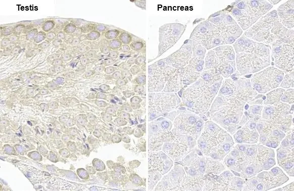 Immunohistochemistry paraffin embedded sections - Anti-VPS35 antibody [HL1017] (AB308334)