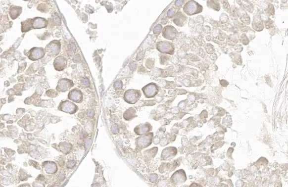 Immunohistochemistry paraffin embedded sections - Anti-VPS35 antibody [HL1017] (ab308334), expandable thumbnail