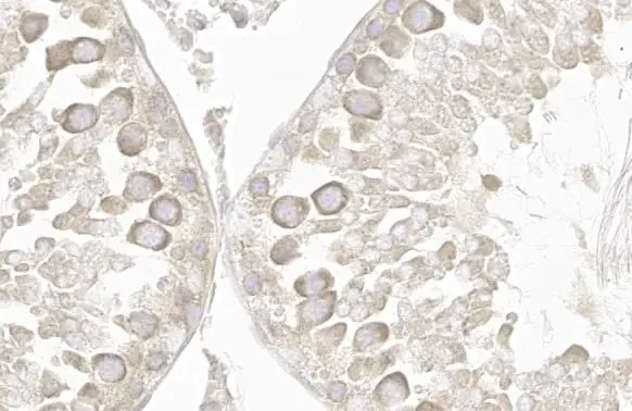 Immunohistochemistry paraffin embedded sections - Anti-VPS35 antibody [HL1017] (AB308334)