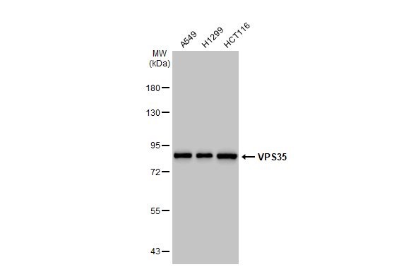 Western blot - Anti-VPS35 antibody [HL1017] (AB308334), expandable thumbnail