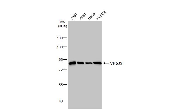 Western blot - Anti-VPS35 antibody [HL1017] (ab308334), expandable thumbnail