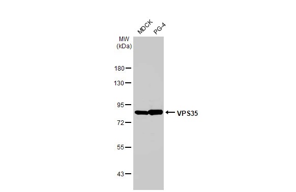 Western blot - Anti-VPS35 antibody [HL1017] (AB308334), expandable thumbnail