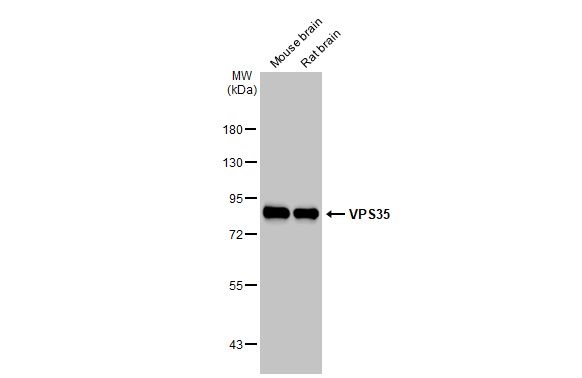 Western blot - Anti-VPS35 antibody [HL1017] (AB308334), expandable thumbnail