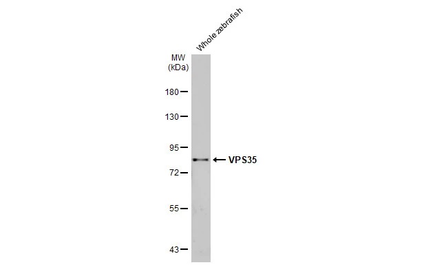 Western blot - Anti-VPS35 antibody [HL1017] (AB308334), expandable thumbnail