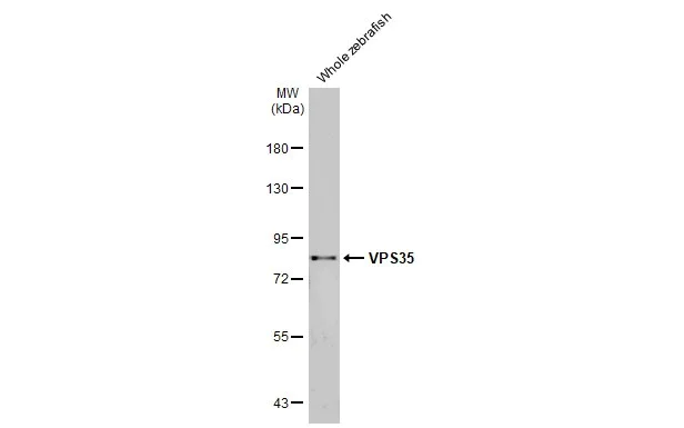 Western blot - Anti-VPS35 antibody [HL1017] (AB308334)