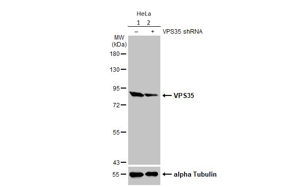 Western blot - Anti-VPS35 antibody [HL1017] (AB308334), expandable thumbnail