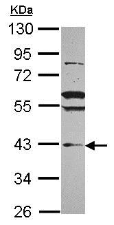 Western blot - Anti-VPS36 antibody (AB101379), expandable thumbnail