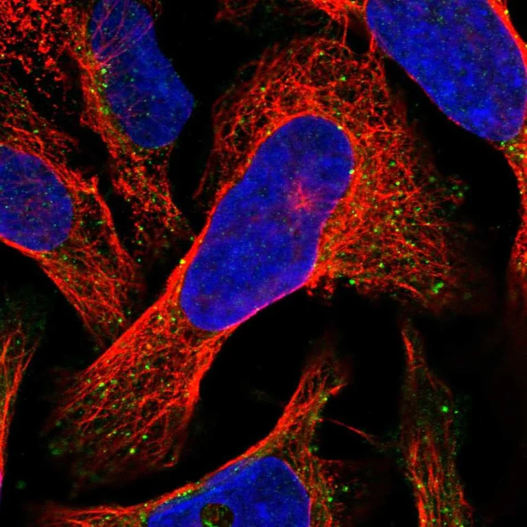 Immunocytochemistry/ Immunofluorescence - Anti-VPS36 antibody (AB247016)