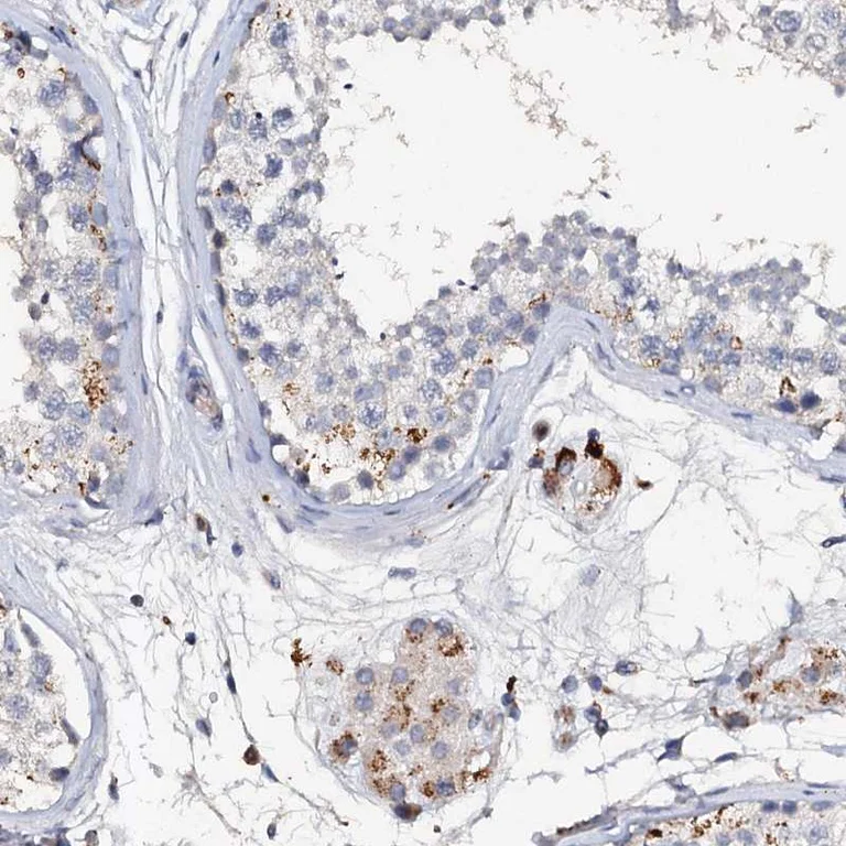 Immunohistochemistry (Formalin/PFA-fixed paraffin-embedded sections) - Anti-VPS36 antibody (AB247016)