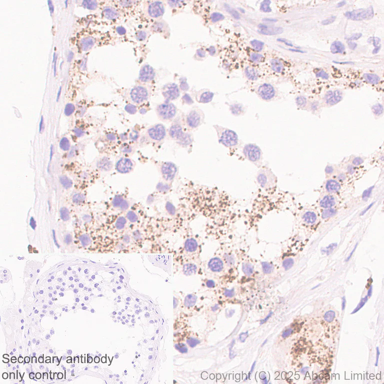 Immunohistochemistry (Formalin/PFA-fixed paraffin-embedded sections) - Anti-VPS36 antibody [EPR30585-7] (AB326563)