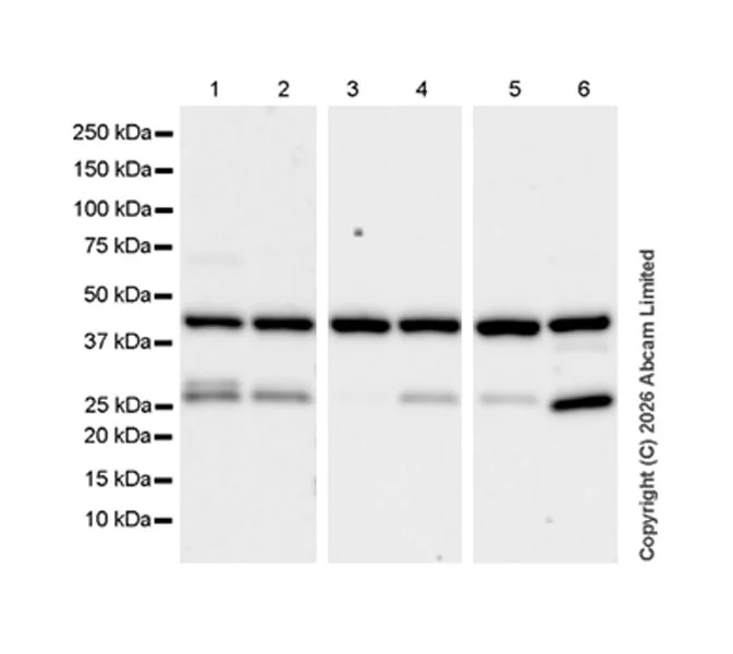 Western blot - Anti-VPS36 antibody [EPR30585-7] (AB326563)