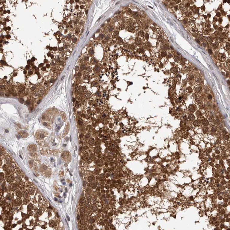 Immunohistochemistry (Formalin/PFA-fixed paraffin-embedded sections) - Anti-VPS37A/HCRP1 antibody (AB251760)