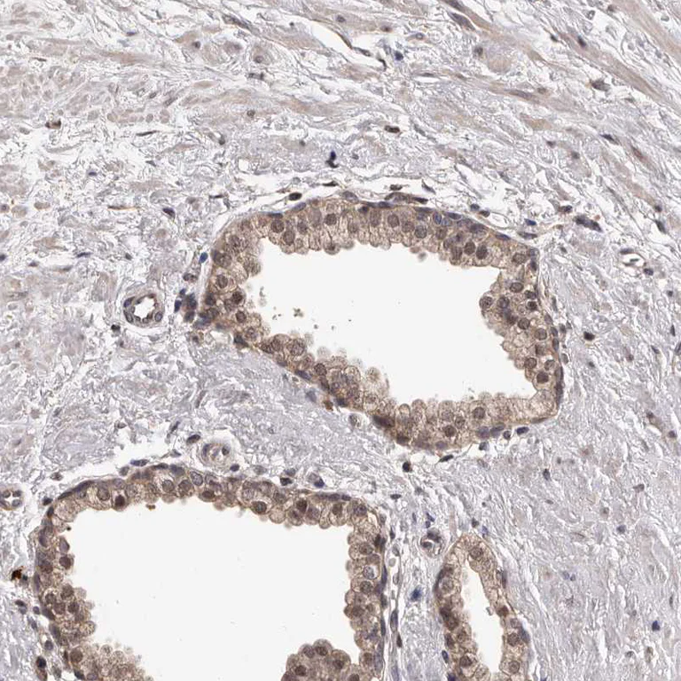 Immunohistochemistry (Formalin/PFA-fixed paraffin-embedded sections) - Anti-VPS37A/HCRP1 antibody (AB251760)
