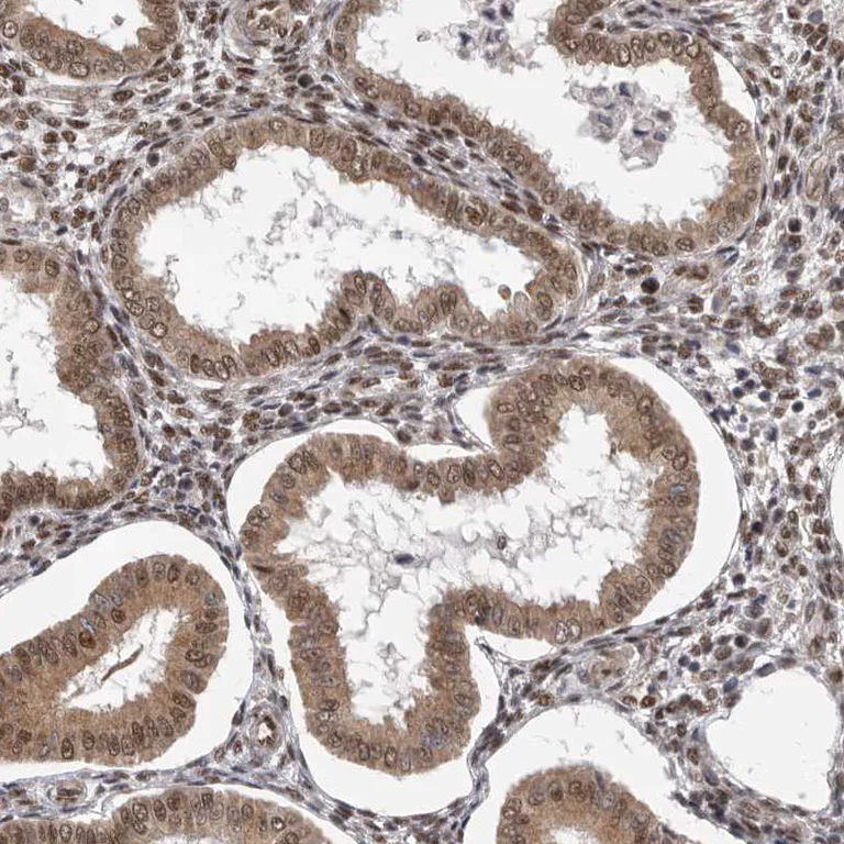 Immunohistochemistry (Formalin/PFA-fixed paraffin-embedded sections) - Anti-VPS37A/HCRP1 antibody (AB251760)