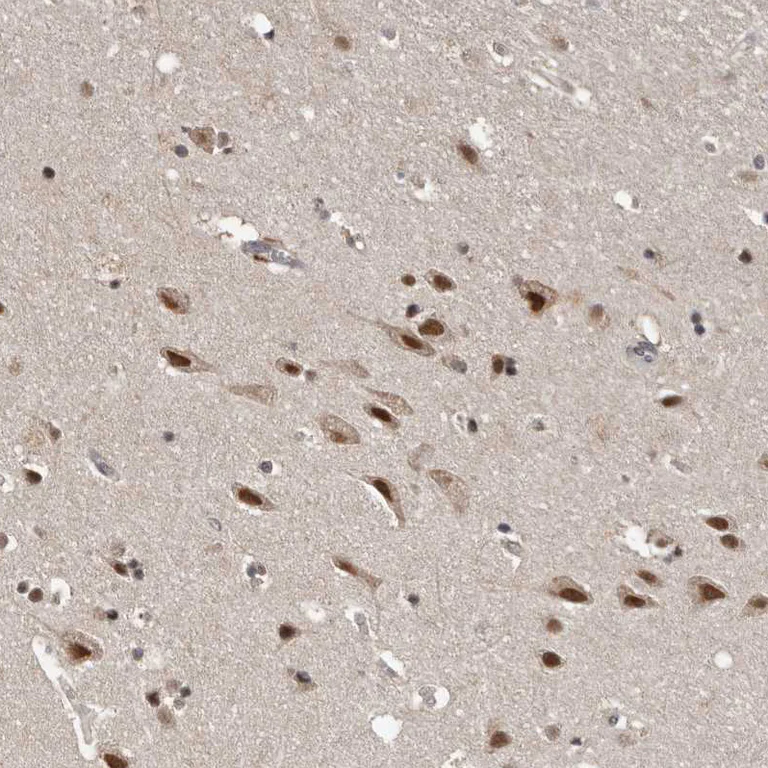 Immunohistochemistry (Formalin/PFA-fixed paraffin-embedded sections) - Anti-VPS37A/HCRP1 antibody (AB251760)