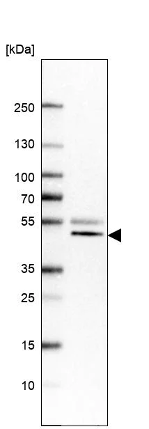 Western blot - Anti-VPS37A/HCRP1 antibody (AB251760)