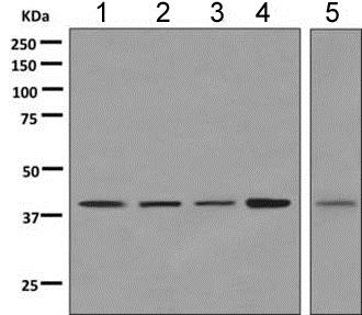 Western blot - Anti-VPS37C antibody [EPR9559] - BSA and Azide free (AB249065), expandable thumbnail