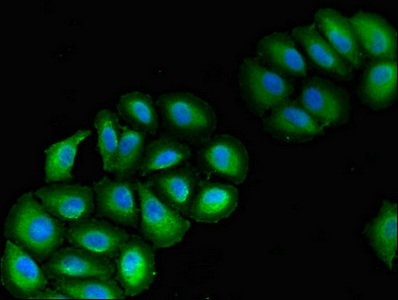Immunocytochemistry/ Immunofluorescence - Anti-VPS39 antibody (AB224671), expandable thumbnail