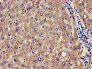 Immunohistochemistry (Formalin/PFA-fixed paraffin-embedded sections) - Anti-VPS39 antibody (AB224671), expandable thumbnail