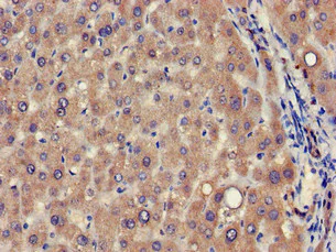 Immunohistochemistry (Formalin/PFA-fixed paraffin-embedded sections) - Anti-VPS39 antibody (AB224671)