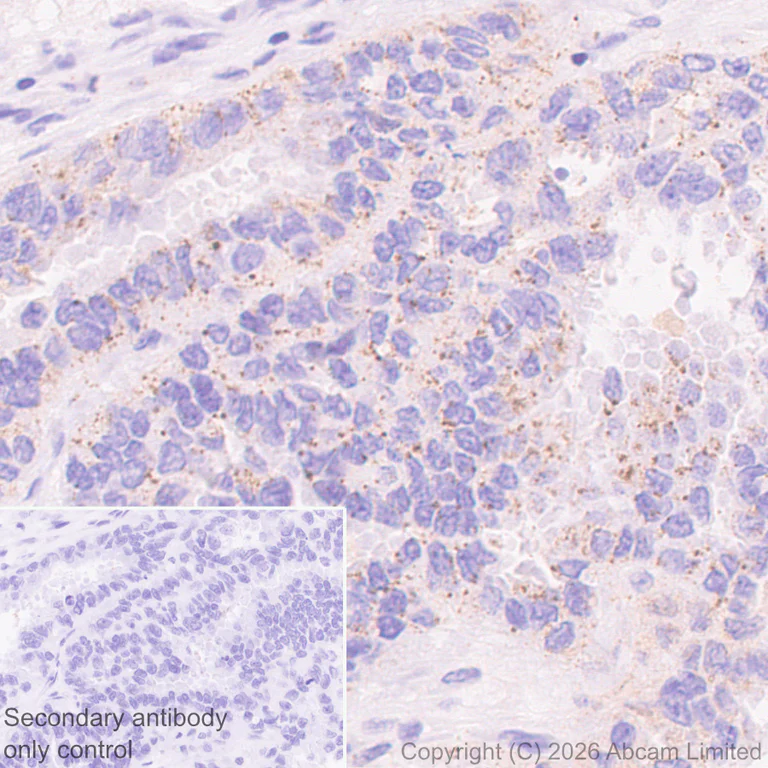 Immunohistochemistry (Formalin/PFA-fixed paraffin-embedded sections) - Anti-VPS4a antibody [EPR30587-24] (AB327386)