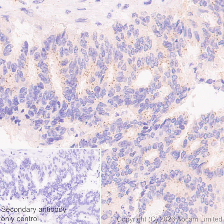 Immunohistochemistry (Formalin/PFA-fixed paraffin-embedded sections) - Anti-VPS4a antibody [EPR30587-24] (AB327386)
