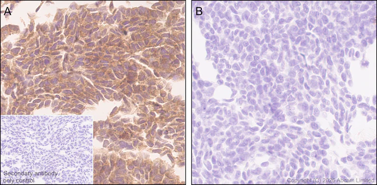 Immunohistochemistry (Formalin/PFA-fixed paraffin-embedded sections) - Anti-VPS4a antibody [EPR30587-24] (AB327386)