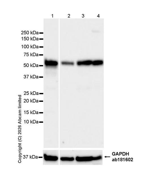 Western blot - Anti-VPS4a antibody [EPR30587-24] (AB327386)