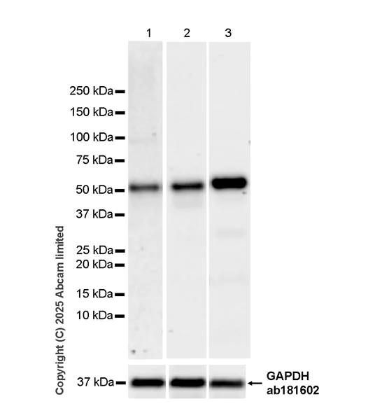 Western blot - Anti-VPS4a antibody [EPR30587-510] (AB325430)