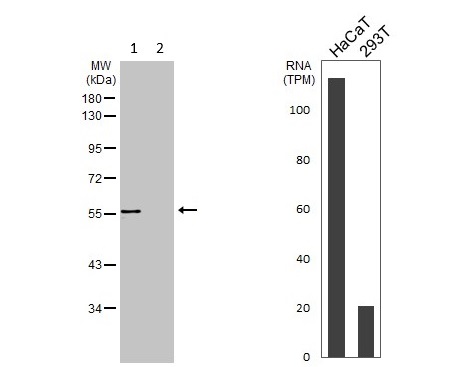 Western blot - Anti-VPS4B/MIG1 antibody (AB102687)