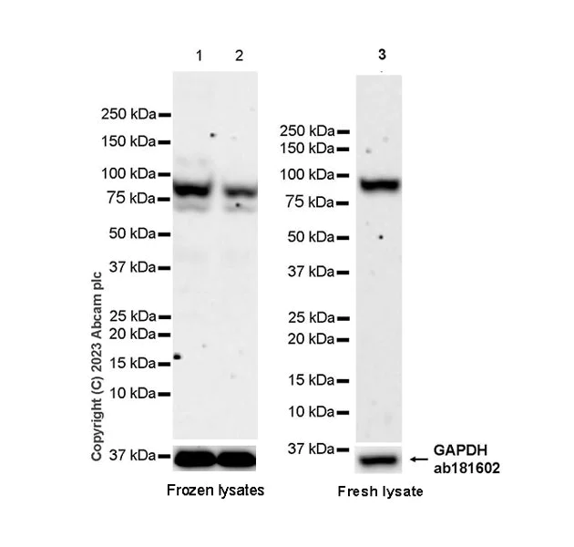 Western blot - Anti-VPS52 antibody [EPR27031-70] - BSA and Azide free (AB313786)