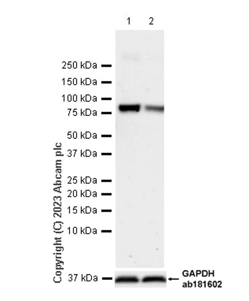 Western blot - Anti-VPS52 antibody [EPR27031-70] - BSA and Azide free (AB313786)