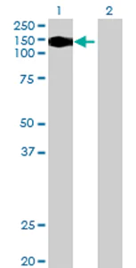 Western blot - Anti-VPS54 antibody (AB69344)