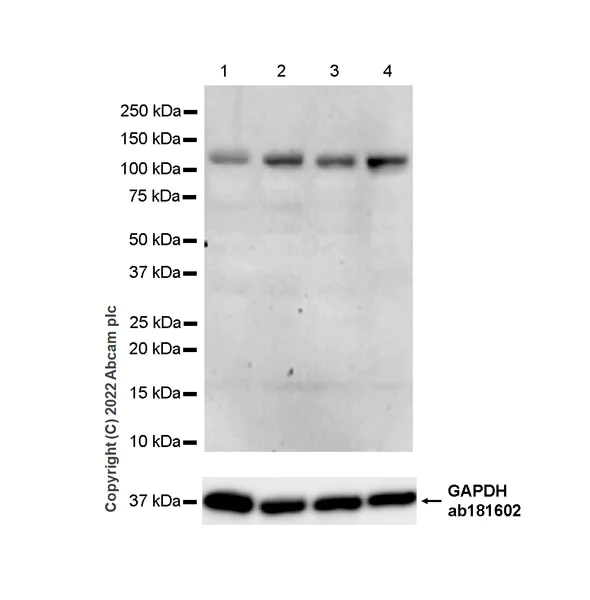 Western blot - Anti-VPS54 antibody [EPR28123-81] (AB307678)