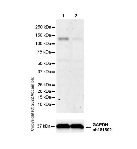 Western blot - Anti-VPS54 antibody [EPR28123-81] (AB307678)