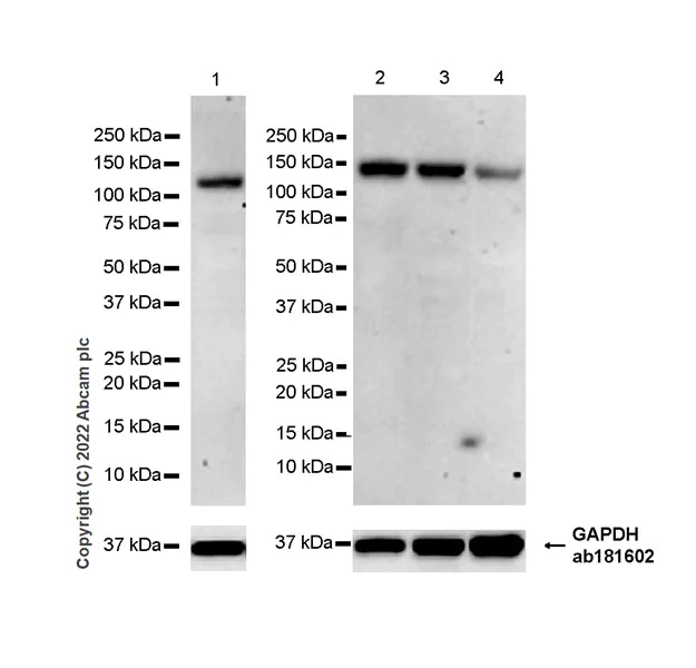 Western blot - Anti-VPS54 antibody [EPR28123-81] (AB307678)