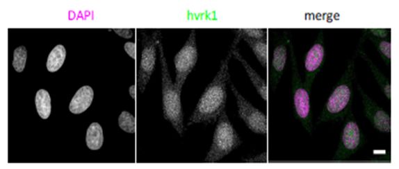 Immunocytochemistry/ Immunofluorescence - Anti-VRK1 antibody [5D1] - N-terminal (AB171933), expandable thumbnail
