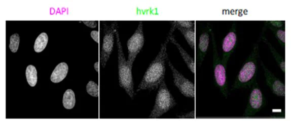 Immunocytochemistry/ Immunofluorescence - Anti-VRK1 antibody [5D1] - N-terminal (AB171933)