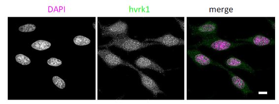 Immunocytochemistry/ Immunofluorescence - Anti-VRK1 antibody [5D1] - N-terminal (ab171933), expandable thumbnail