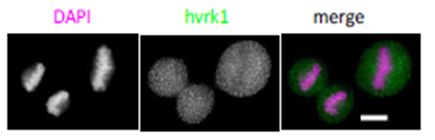 Immunocytochemistry/ Immunofluorescence - Anti-VRK1 antibody [5D1] - N-terminal (ab171933), expandable thumbnail